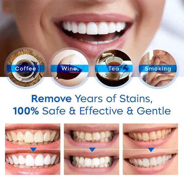 Teeth Whitening Essence Pen
