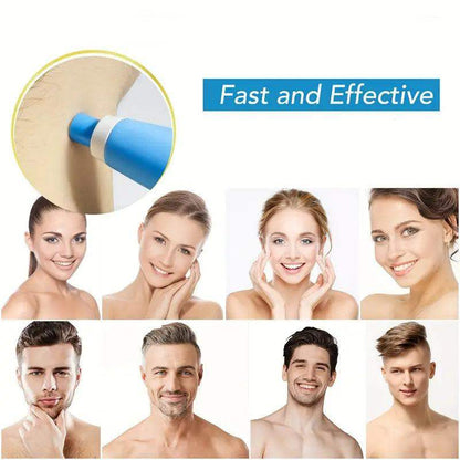 Skin Tag Removal Kit